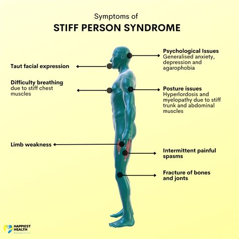 stiff person syndrome early symptoms.